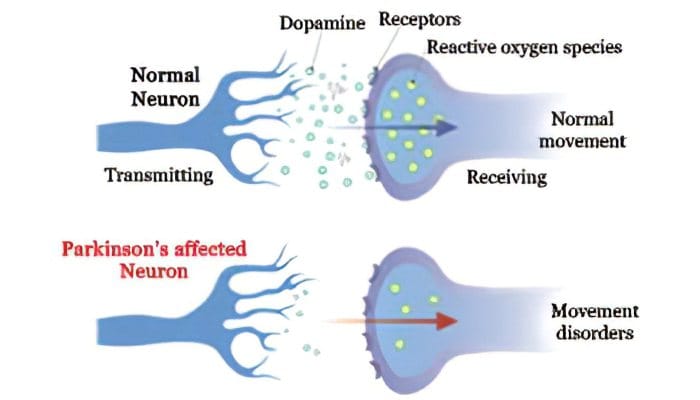 The role of dopamine in disease